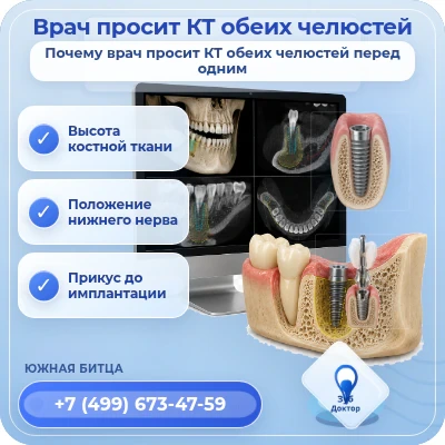 КТ обеих челюстей перед имплантом