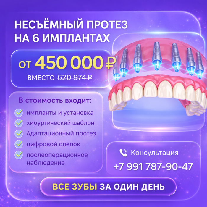 Имплантация все на 6