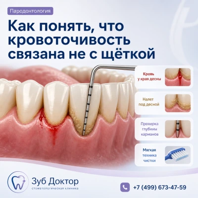 Кровоточивость связана не с щеткой