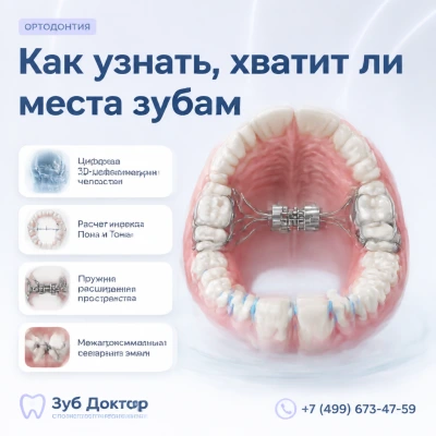 Как узнать, хватит ли места зубам