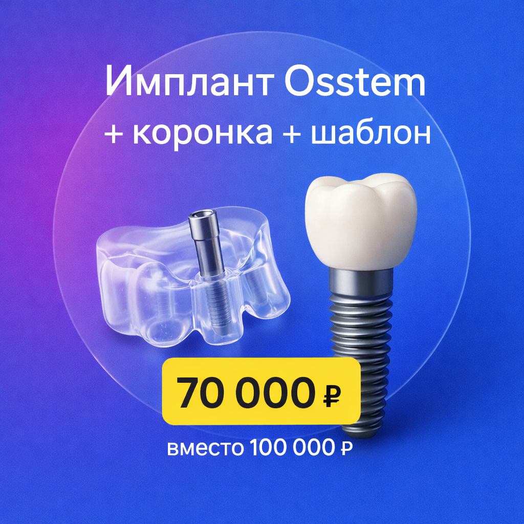 Ипланты по акции Ипланты по акции