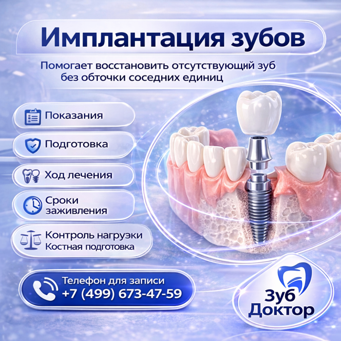 Имплантация зубов