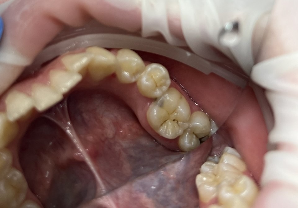 Состояние до лечения