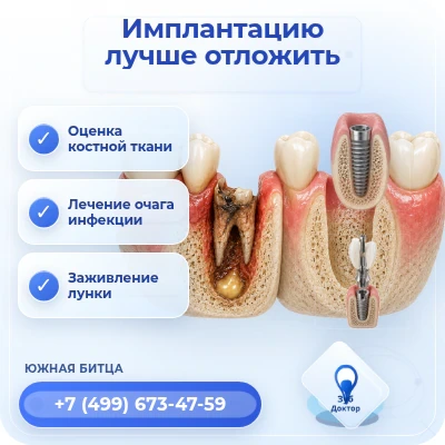 Имплант лучше отложить, даже если зуб удален