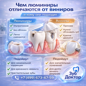 Люминиры или виниры