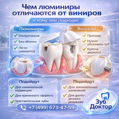 Люминиры или виниры