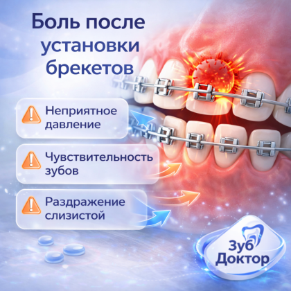 Болят зубы после установки брекетов: что делать?