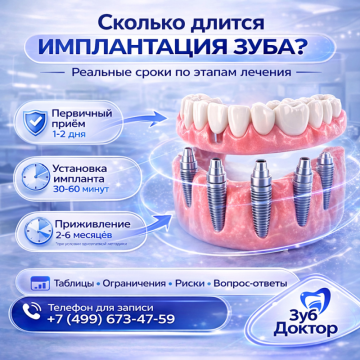 Сколько длится имплантация зуба