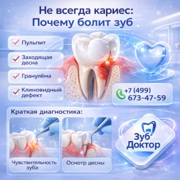 Кариес или десна