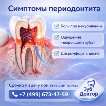 Симптомы периодонтита