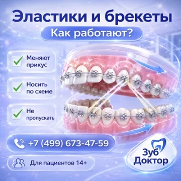 Забыл носить резинки на брекетах: чем это мешает лечению