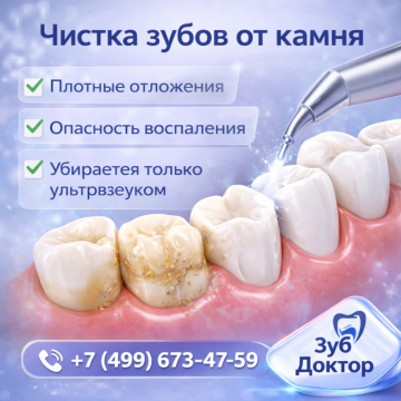 Чистка зубов от камня