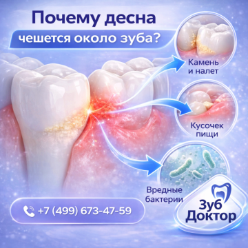 Десна чешется около зуба
