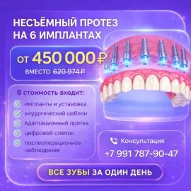 Имплантация все на 6