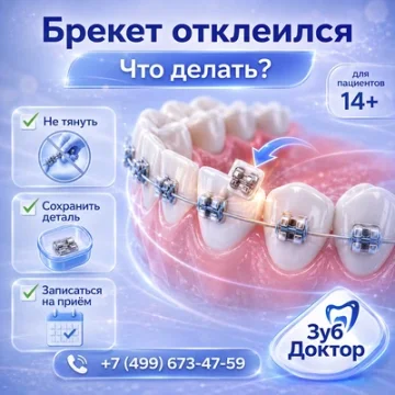 Почему ортодонт переклеивает брекет во время лечения