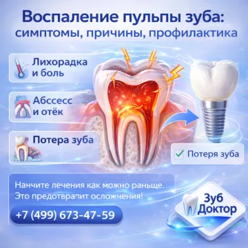 Пульпит и риск потери зуба