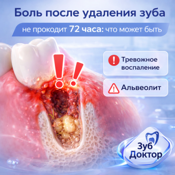 Боль после удаления
