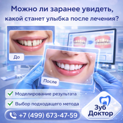 Улыбку видно заранее
