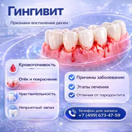 Гингивит