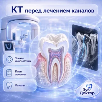 Зачем КТ перед лечением каналов