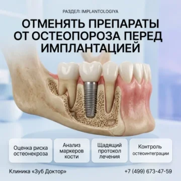Препараты от остеопороза перед имплантацией зубов