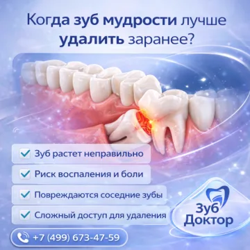 Удалять зубы мудрости заранее