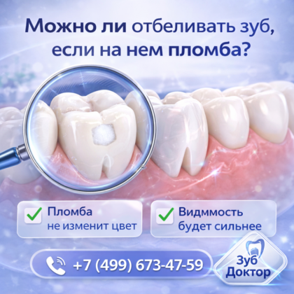 Пломба и отбеливание