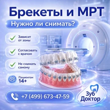 Брекеты и МРТ: нужно ли снимать систему перед исследованием
