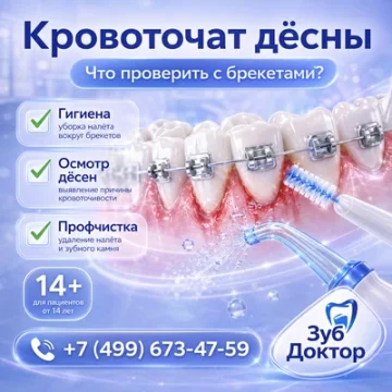 Кровоточат дёсны с брекетами: что проверить в первую очередь