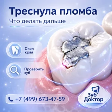 Пломба треснула: можно ли восстановить зуб