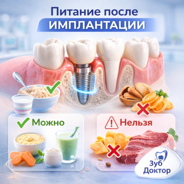 Питание после имплантации