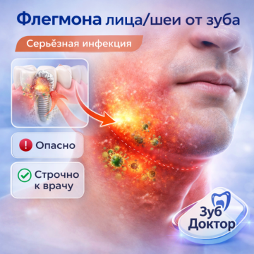 Флегмона лица-шеи от зуба