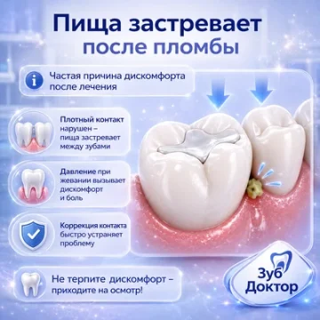 Пища застревает после пломбы: почему так бывает