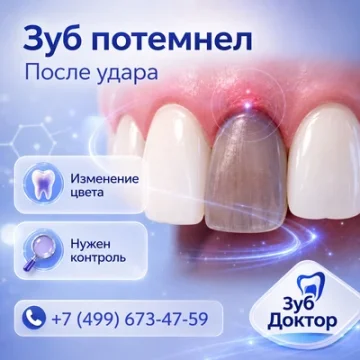 Зуб потемнел после удара: почему нужен снимок