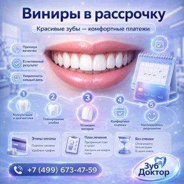 Виниры в рассрочку: как планировать оплату