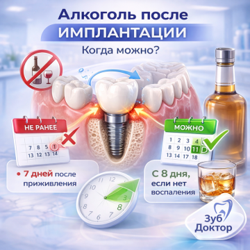 Алкоголь после имплантации