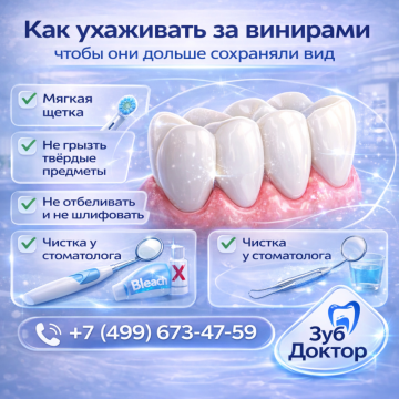 Как ухаживать за винирами