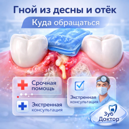 Гной из десны и отёк