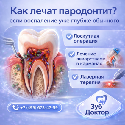 Лечение пародонтита