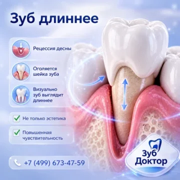 Зуб кажется длиннее: когда это рецессия десны