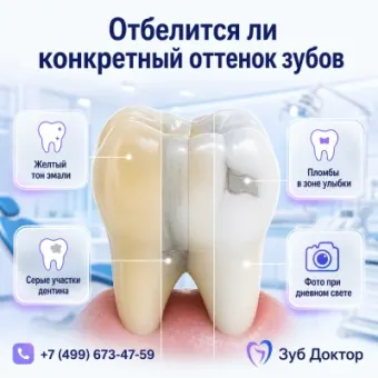 Как понять, отбелится ли оттенок зубов