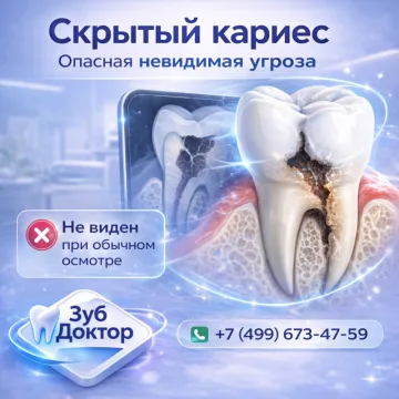 Скрытый кариес