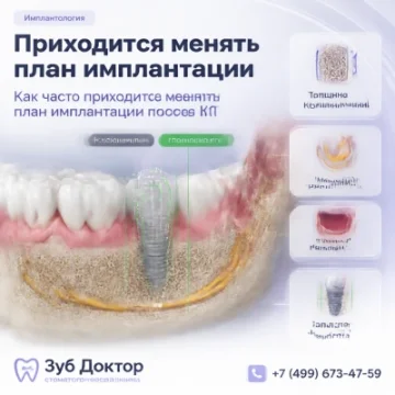 Приходится менять план имплантации