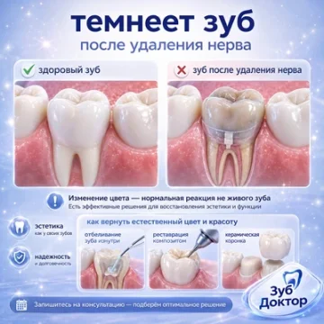 Темнеет зуб после удаления нерва: что можно сделать