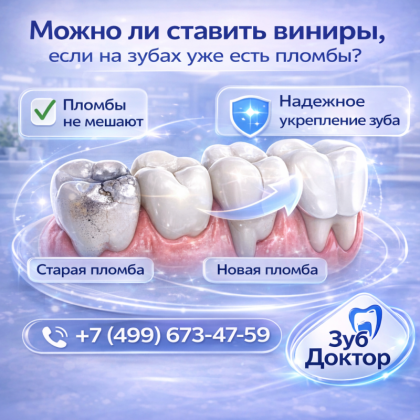 Виниры ставить на пломбы
