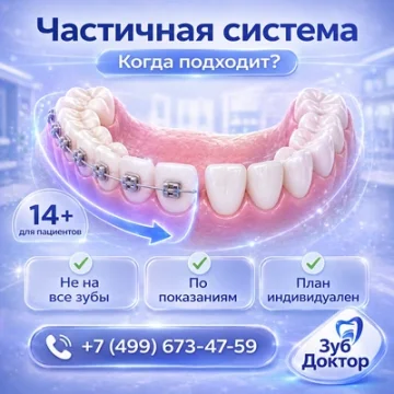 Почему брекеты ставят не на все зубы сразу