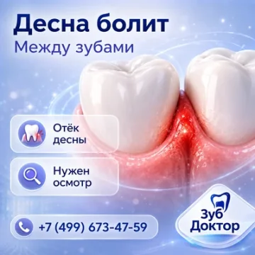Болит десна между зубами: кариес или пища застревает