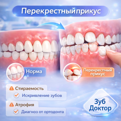 Лечение перекрестного прикуса, что нужно знать?