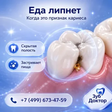Еда липнет к зубу: когда это признак кариеса