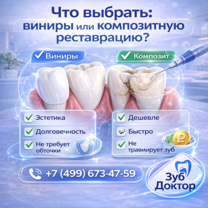Виниры или композит